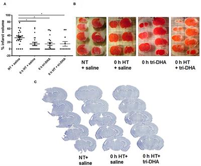 Acute Injection of Omega-3 Triglyceride Emulsion Provides Very Similar Protection as Hypothermia in a Neonatal Mouse Model of Hypoxic-Ischemic Brain Injury